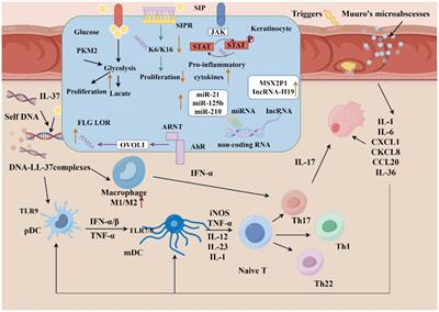 Promising strategies in natural products treatments of psoriasis-update